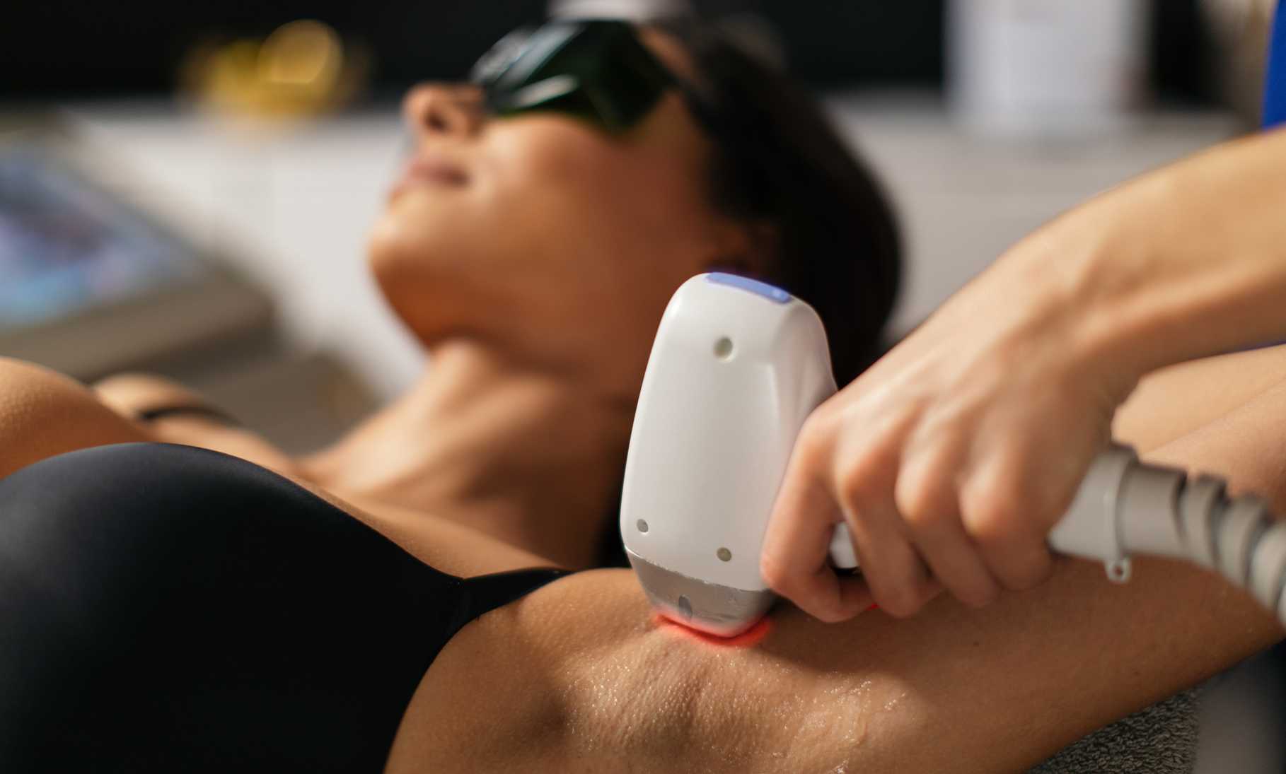 How Does Laser Hair Removal Work?