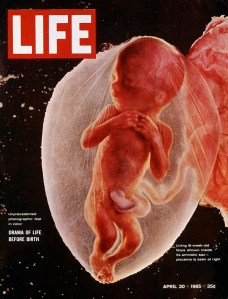 LIFE Magazine, 'Drama of Life Before Birth,' Lennart Nilsson