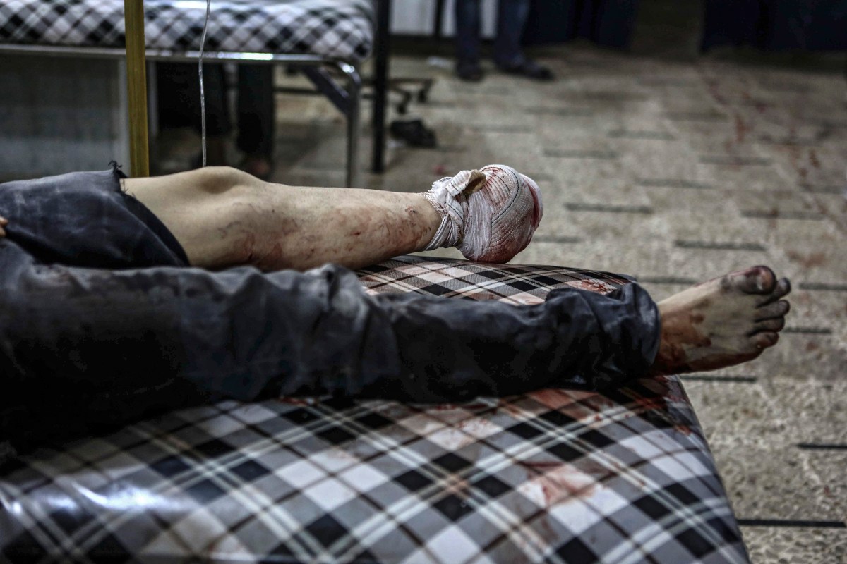 A man receives medical care in a field hospital after an airstrike in Douma on Sept. 12. Mohammed BadraÃ¢Â€Â”EPA